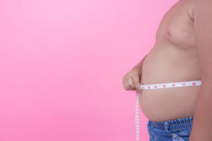intervento di chirurgia bariatric