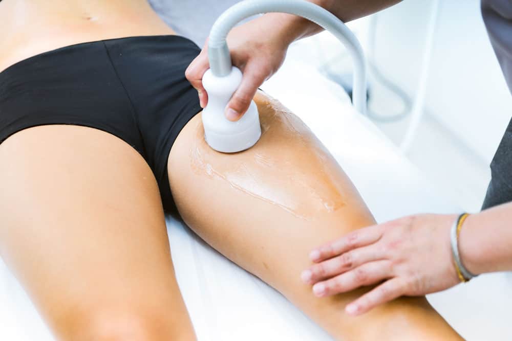 Crioterapia cellulite